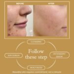 Kadife | Anti-Oxidant Serum, 30ml, Brightening & Glowing Skin Complexion, with Alpha Arbutin, Allantoin & Acerola Extract For all Skin Type - Image 8